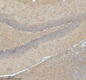 IHC staining of FFPE rat hippocampus tissue with HDHD5 antibody. HIER: boil tissue sections in pH8 EDTA for 20 min and allow to cool before testing.