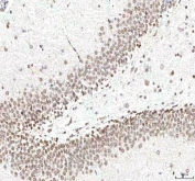 IHC staining of FFPE human rat brain tissue with PHF6 antibody. HIER: boil tissue sections in pH8 EDTA for 20 min and allow to cool before testing.