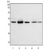 Western blot testing of 1) human A549, 2) human HepG2, 3) human Jurkat, 4) human K562 and 5) mouse brain tissue lysate with Phosphoglucomutase 3 antibody. Predicted molecular weight: 60-63 kDa (multiple isoforms).
