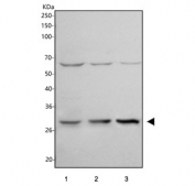 Western blot testing of human 1) HeLa, 2) 293T and 3) U-2 OS cell lysate with Histone H1.10 antibody. Predicted molecular weight ~22 kDa.