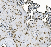 IHC staining of FFPE human placental tissue with ANAPC1 antibody. HIER: boil tissue sections in pH8 EDTA for 20 min and allow to cool before testing.