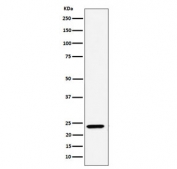 Western blot testing of human A549 cell lysate with DNAJC12 antibody. Predicted molecular weight ~23 kDa.
