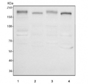 Western blot testing of 1) human MCF7, 2) rat brain, 3) rat PC-12 and 4) mouse brain tissue lysate with HER4 antibody. Predicted molecular weight: 147-180kDa (precursor), 120, 80 kDa (cleaved forms).