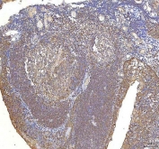 IHC staining of FFPE human tonsil tissue with Oncomodulin 1 antibody. HIER: boil tissue sections in pH8 EDTA for 20 min and allow to cool before testing.