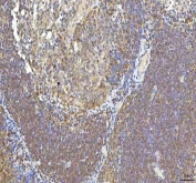 IHC staining of FFPE human tonsil tissue with Oncomodulin 1 antibody. HIER: boil tissue sections in pH8 EDTA for 20 min and allow to cool before testing.