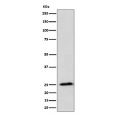 Western blot testing of human HeLa cell lysate with RPL10A antibody. Predicted molecular weight ~25 kDa.