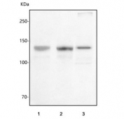 Western blot testing of human 1) U-2 OS, 2) SH-SY5Y and 3) Jurkat cell lysate with PHC1 antibody. Predicted molecular weight ~105 kDa but commonly observed at 125-135 kDa.