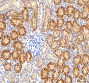 IHC staining of FFPE mouse kidney tissue with HSDL2 antibody. HIER: boil tissue sections in pH8 EDTA for 20 min and allow to cool before testing.