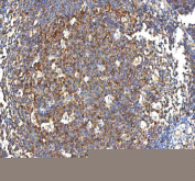 IHC staining of FFPE human tonsil tissue with PFKP antibody. HIER: boil tissue sections in pH8 EDTA for 20 min and allow to cool before testing.