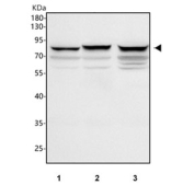 Western blot testing of human 1) 293T, 2) Jurkat and 3) MCF7 cell lysate with PFKP antibody. Predicted molecular weight ~86 kDa.