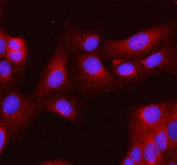 Immunofluorescent staining of FFPE human U-2 OS cells with MLKL antibody (red) and DAPI nuclear stain (blue). HIER: steam section in pH6 citrate buffer for 20 min.