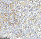 IHC staining of FFPE human testicular seminoma tissue with HDHD2 antibody. HIER: boil tissue sections in pH8 EDTA for 20 min and allow to cool before testing.