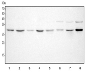 Western blot testing of 1) human Jurkat, 2) human ThP-1, 3) human K562, 4) human HEL, 5) rat kidney, 6) rat brain, 7) mouse kidney and 8) mouse brain tissue lysate with HDHD2 antibody. Predicted molecular weight ~28 kDa.