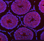Immunofluorescent staining of FFPE human rat testis tissue with STIM1 antibody (red) and DAPI nuclear stain (blue). HIER: steam section in pH8 EDTA buffer for 20 min.