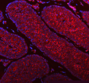 Immunofluorescent staining of FFPE human mouse testis tissue with STIM1 antibody (red) and DAPI nuclear stain (blue). HIER: steam section in pH8 EDTA buffer for 20 min.