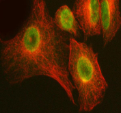Immunofluorescent staining of FFPE human A549 cells with ARHGEF12 antibody (red) and Beta Tubulin mAb (red). HIER: steam section in pH6 citrate buffer for 20 min.
