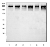 Western blot testing of 1) human HeLa, 2) human HepG2, 3) rat brain, 4) rat testis, 5) mouse brain and 6) mouse testis tissue lysate with LARG antibody. Predicted molecular weight ~173 kDa but commonly observed at up to 220 kDa, possibly due to phosphorylation.