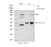 Immunoprecipitation of MIB2 protein from 500ug of human A431 whole cell lysate with 2ug of MIB2 antibody.