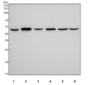 Western blot testing of human 1) K562, 2) A431, 3) HepG2, 4) 293T, 5) PC-3 and 6) SiHa cell lysate with SLC16A1 antibody. Predicted molecular weight ~54 kDa and ~46 kDa (two isoforms).