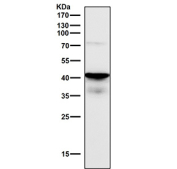 Western blot testing of human HepG2 cell lysate with TARDBP antibody. Predicted molecular weight ~45 kDa, commonly observed at 43-45 kDa.