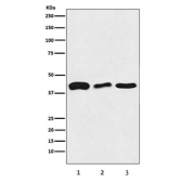 Western blot testing of 1) human HeLa, 2) mouse brain and 3) rat brain tissue lysate with TAR DNA binding protein 43 antibody. Predicted molecular weight ~45 kDa, commonly observed at 43-45 kDa.