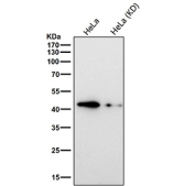 Western blot testing of human HeLa cell lysate (wild type and knock down) with TAR DNA binding protein 43 antibody. Predicted molecular weight ~45 kDa, commonly observed at 43-45 kDa.