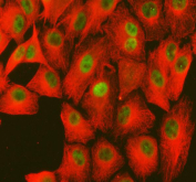 Immunofluorescent staining of FFPE human A549 cells with ME1 antibody (green) and Alpha Tubulin mAb (red). HIER: steam section in pH6 citrate buffer for 20 min.