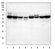 Western blot testing of 1) human Caco-2, 2) human A549, 3) human HeLa, 4) human HaCaT, 5) rat liver and 6) rat kidney, 7) mouse liver and 8) mouse kidney tissue lysate with ME1 antibody. Predicted molecular weight ~64 kDa and ~55 kDa (two isoforms).