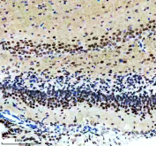 IHC staining of FFPE mouse brain tissue with Alpha-Synuclein antibody, HRP-secondary and DAB substrate. HIER: boil tissue sections in pH8 EDTA for 20 min and allow to cool before testing.