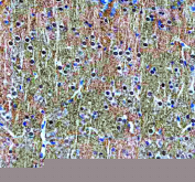 IHC staining of FFPE rat brain tissue with Alpha-Synuclein antibody, HRP-secondary and DAB substrate. HIER: boil tissue sections in pH8 EDTA for 20 min and allow to cool before testing.