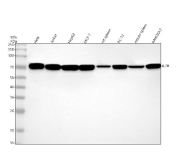 Western blot testing of 1) human HeLa, 2) human Jurkat, 3) human HepG2, 4) human MCF7, 5) rat spleen, 6) rat PC-12, 7) mouse spleen and 8) mouse RAW264.7 cell lysate with IL7RA antibody. Predicted molecular weight ~52kDa but can be observed at higher molecular weights due to glycosylation.