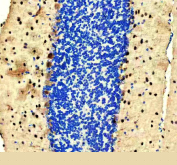 IHC staining of FFPE mouse cerebellum tissue with PVALB antibody, HRP-secondary and DAB substrate. HIER: boil tissue sections in pH8 EDTA for 20 min and allow to cool before testing.