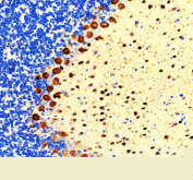 IHC staining of FFPE rat cerebellum tissue with PVALB antibody, HRP-secondary and DAB substrate. HIER: boil tissue sections in pH8 EDTA for 20 min and allow to cool before testing.