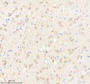 IHC staining of FFPE rat brain tissue with GABARAPL2 antibody, HRP-secondary and DAB substrate. HIER: boil tissue sections in pH8 EDTA for 20 min and allow to cool before testing.