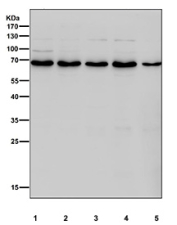 Western blot testing of human 1) HeLa, 2) Jurkat, 3) HepG2, 4) MCF7 and 5) SH-SY5Y cell lysate with PDC-E2 antibody. Predicted molecular weight ~69 kDa.