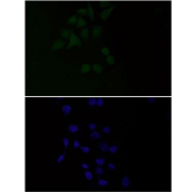 Immunofluorescent staining of FFPE human HeLa cells with PDC-E2 antibody (green) and DAPI nuclear stain (blue). HIER: steam section in pH6 citrate buffer for 20 min.