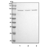 Western blot testing of human 1) PC-3, 2) HEL and 3) U-251 cell lysate with ATRIP antibody. Predicted molecular weight ~86 kDa.