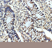 IHC staining of FFPE human colon tissue with CHMP2B antibody, HRP-secondary and DAB substrate. HIER: boil tissue sections in pH8 EDTA for 20 min and allow to cool before testing.