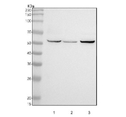 Western blot testing of human 1) HeLa, 2) HepG2 and 3) A549 cell lysate with CAMK2 antibody. Predicted molecular weight ~54 kDa.