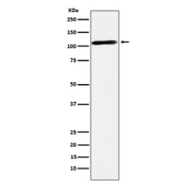 Western blot testing of human fetal brain tissue lysate with RAPGEF4 antibody. Predicted molecular weight ~115 kDa.