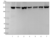 Western blot testing of 1) human SiHa, 2) human 293T, 3) human HepG2, 4) rat testis, 5) rat PC-12, 6) mouse testis and 7) mouse NIH 3T3 cell lysate with PHF8 antibody. Predicted molecular weight: 98-118 kDa (multiple isoforms). PHF8 may be observed at higher molecular weights due to sumoylation, ubiquitylation and phosphorylation.