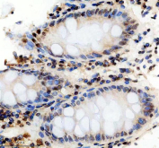 IHC staining of FFPE human colon tissue with PHF8 antibody, HRP-secondary and DAB substrate. HIER: boil tissue sections in pH8 EDTA for 20 min and allow to cool before testing.