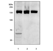 Western blot testing of human 1) U-251, 2) K562 and 3) PC-3 cell lysate with SMC4 antibody. Predicted molecular weight ~147 kDa.