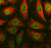 Immunofluorescent staining of FFPE human HeLa cells with SMC4 antibody (green) and Alpha Tubulin mAb (red). HIER: steam section in pH6 citrate buffer for 20 min.