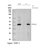 Immunoprecipitation of PDCD2 protein from 500ug of human ThP-1 whole cell lysate with 2ug of PDCD2 antibody.