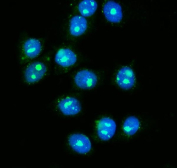 Immunofluorescent staining of FFPE human MCF7 cells with GAR1 antibody (green) and DAPI nuclear stain (blue). HIER: steam section in pH6 citrate buffer for 20 min.