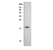 Western blot testing of human HeLa cell lysate with SRP14 antibody. Expected molecular weight ~15 kDa.