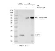 Immunoprecipitation of SRP14 protein from 500ug of human PC-3 whole cell lysate with 2ug of SRP14 antibody.