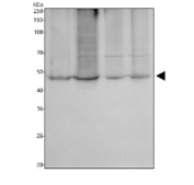 Western blot testing of human 1) HeLa, 2) PC-3, 3) HepG2 and 4) Caco-2 cell lysate with DGAT1 antibody. Predicted molecular weight ~55 kDa, commonly observed at 45-55 kDa.