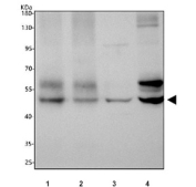 Western blot testing of 1) rat hippocampus, 2) rat brain, 3) rat C6 and 4) mouse brain tissue lysate with CAMK II alpha antibody. Predicted molecular weight ~54 kDa. An additional ~65 kDa band is often observed.